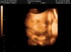 chubbybaby_104.jpg