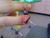myrotoratemyfinger.jpg