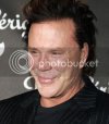 mickey-rourke-bad-plastic-surgery.jpg