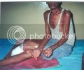 leprosy2.jpg