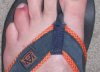 toe injury.jpg