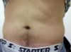 tummy.JPG