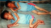 208415-starving-kids-north-korea.jpg